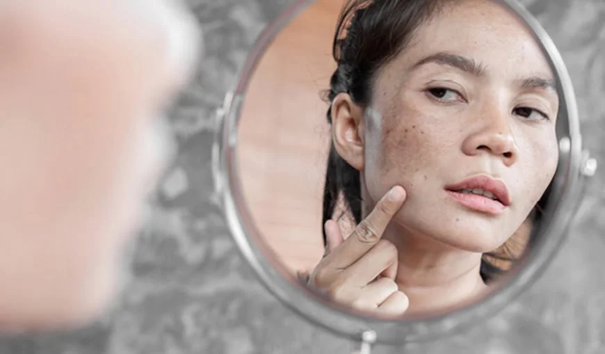 Effective natural ways of reducing pigmentation on skin - find simple and powerful natural ingredients with skin-lightening properties and reduce dark spots.