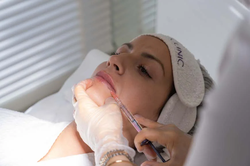 Lip fillers at Lucia Clinic, the most popular treatments - learn everything you want to know about these effective injectable treatments with minimal downtime.