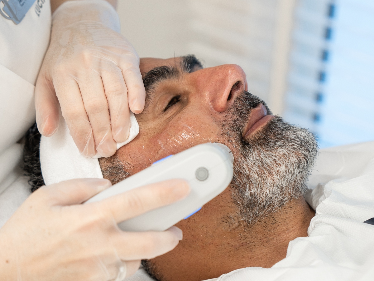 ULTHERAPY TREATMENT