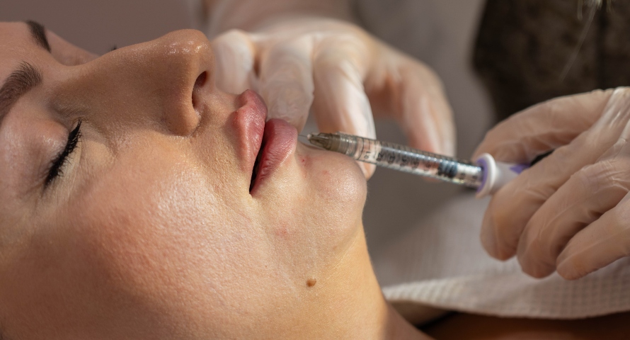 A close-up of a woman receiving dermal filler injections to enhance her lips and chin.