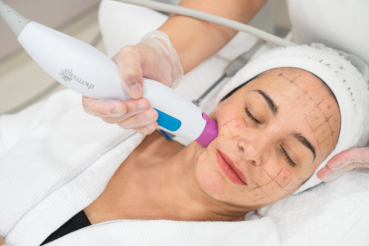 A woman trying one of the newest generation skin tightening treatments