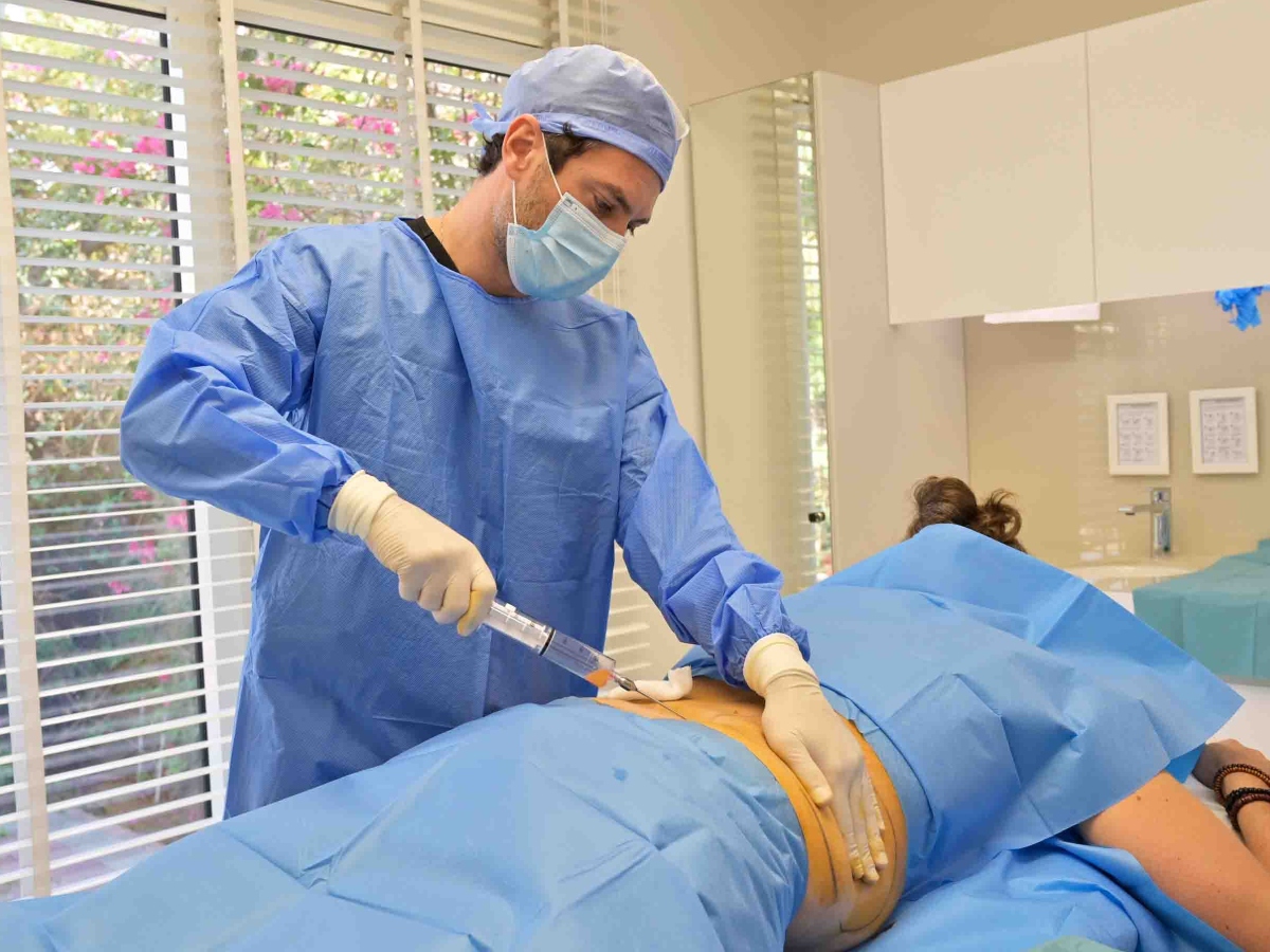 Fat grafting, a great plastic surgery