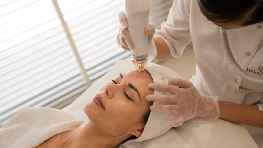 Secret RF Microneedling.