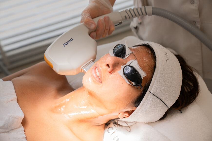 AFT (photo rejuvenation at Lucia Clinic)