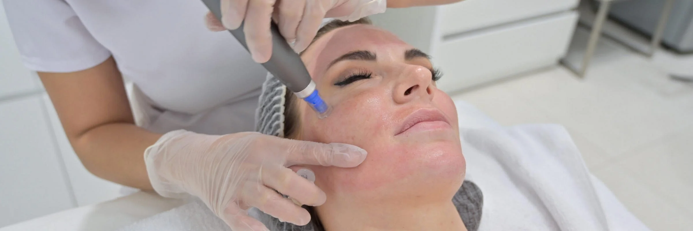 Dermapen Treatment