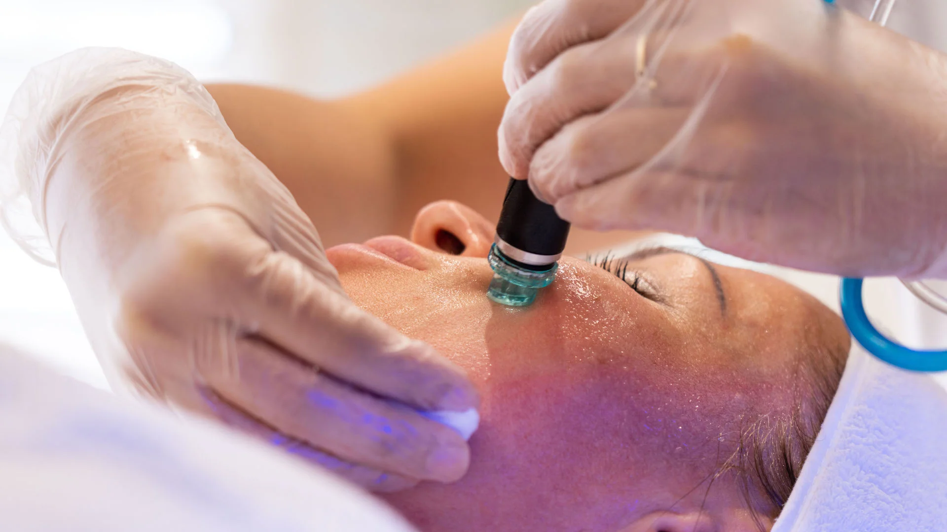 HydraFacial advanced treatment for supreme-looking skin - pamper your skin and make it radiant and smooth with gentle resurfacing hydra-dermabrasion procedure.
