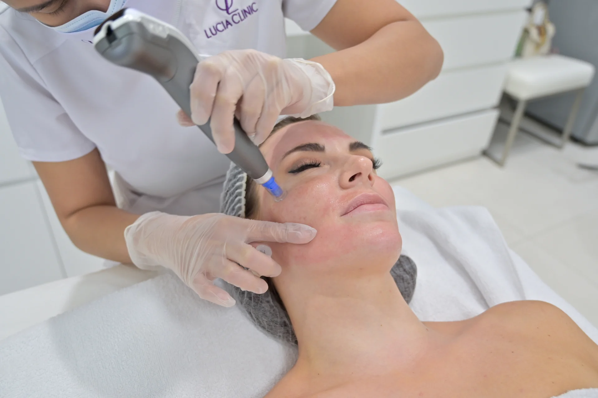 Microneedling treatment for effective collagen remodeling - improve skin appearance with advanced and safe skin firming and skin concerns reduction treatment.