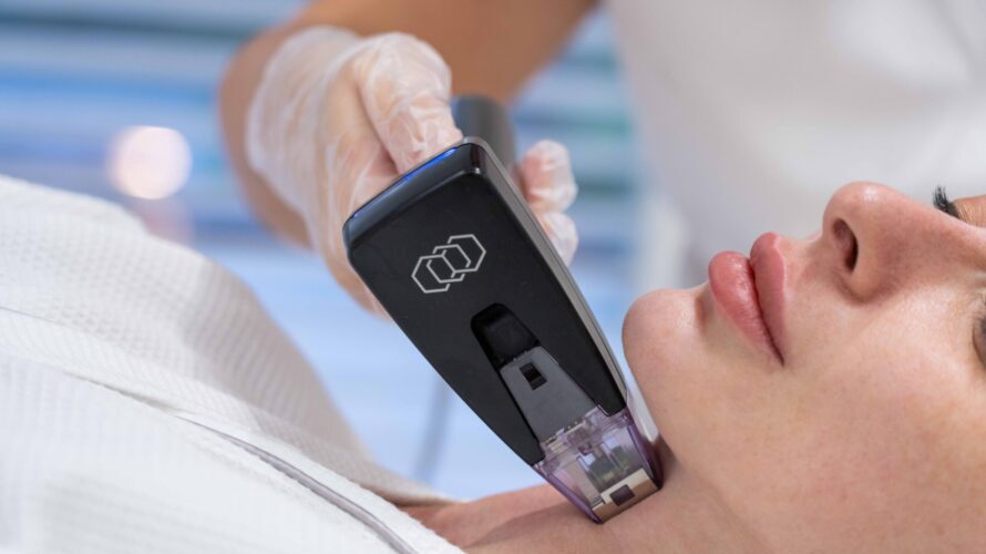 Acne scar removal treatment at Lucia Clinic