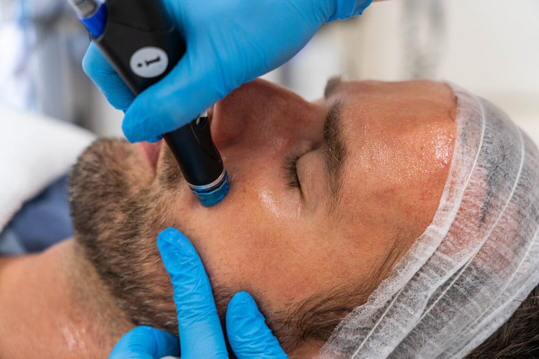 Facial for Men | Lucia Clinic Dubai