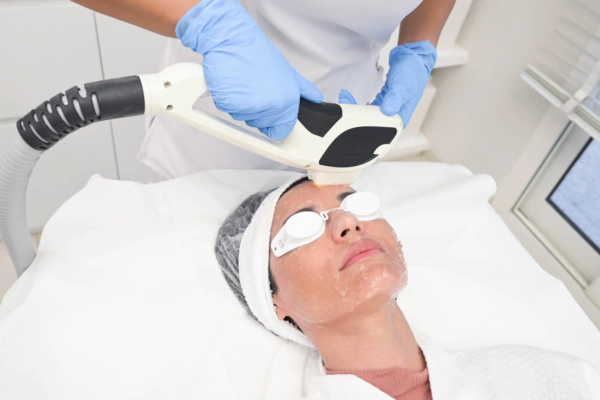 Viora IPL for restoring the beauty and balance of the skin - rejuvenate your skin with the treatment that uses heat and light to target specific skin concerns.