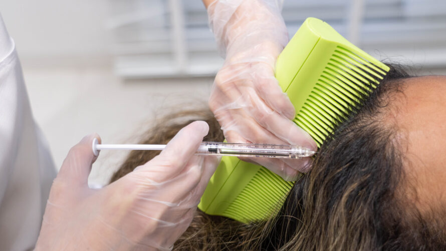 Hair growth treatment