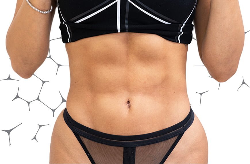 A QUICK WAY TO 6-PACK ABS - PLASTIC SURGERY