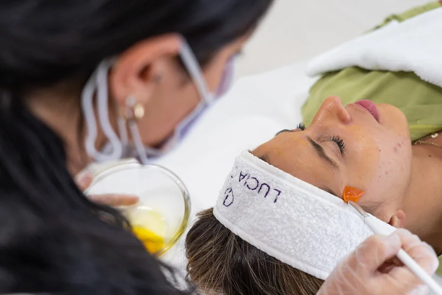 Chemical peels, 101 guide to popular aesthetic treatment - find out about benefits, types, customization and purpose of this effective and versatile treatment.