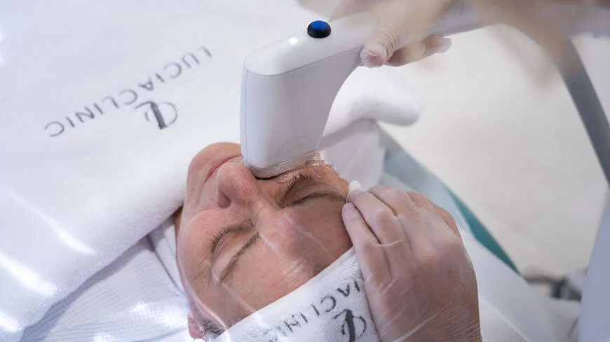 Sofwave, a superstar in the skin lifting and tightening - experience the benefits of this non-invasive anti-aging treatment and rejuvenate your facial skin.