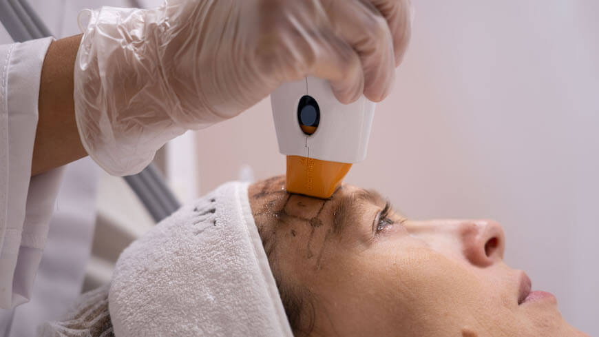 Ultherapy, the treatment that firms skin with ultrasound