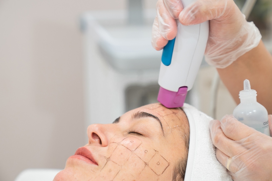 Thermage the ultimate facial skin regeneration treatment - reverse signs of aging and contour your facial features with this advanced non-surgical treatment. 
