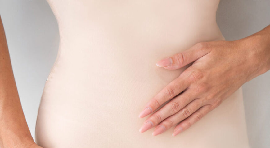 A woman after liposuction