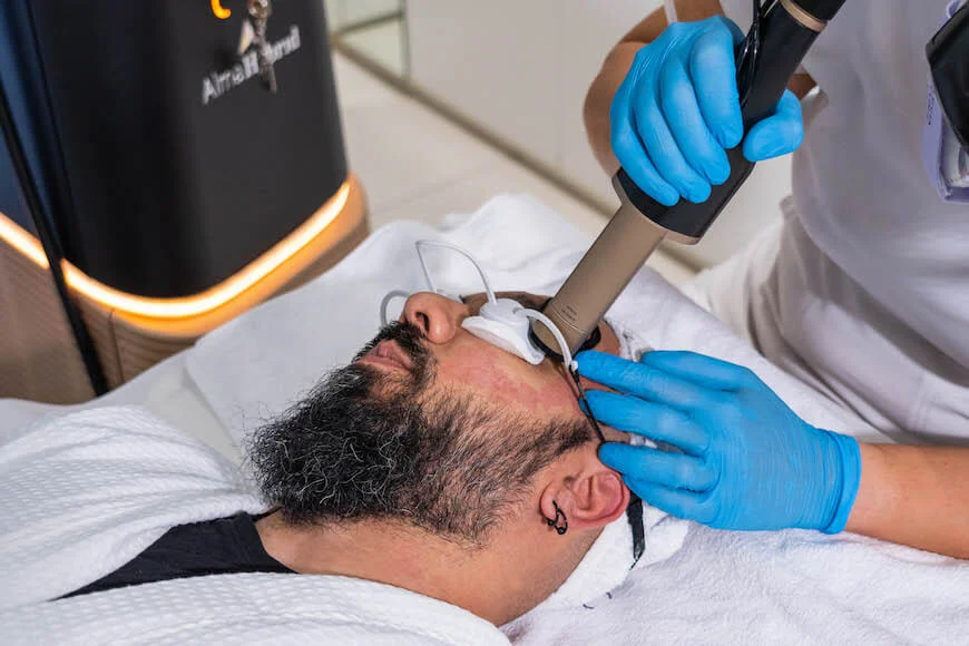 Laser skin resurfacing, best skincare treatment for men - reduce wrinkles or scars and improve the texture of your skin with the advanced Alma Hybrid treatment. 