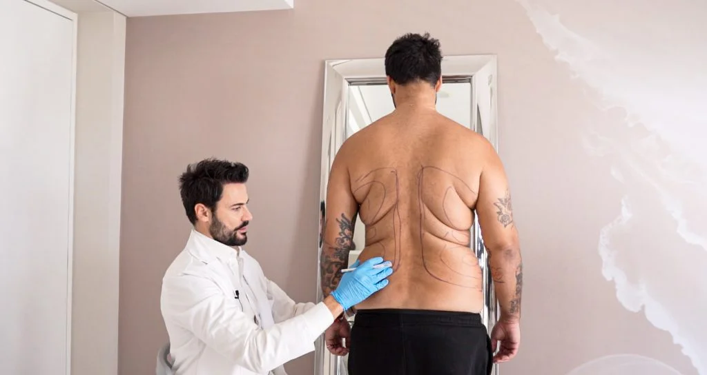 The most advanced plastic surgery for men at Lucia Clinic - achieve your aesthetic goals with the customized liposuction, gynecomastia surgery or eyelid lift.