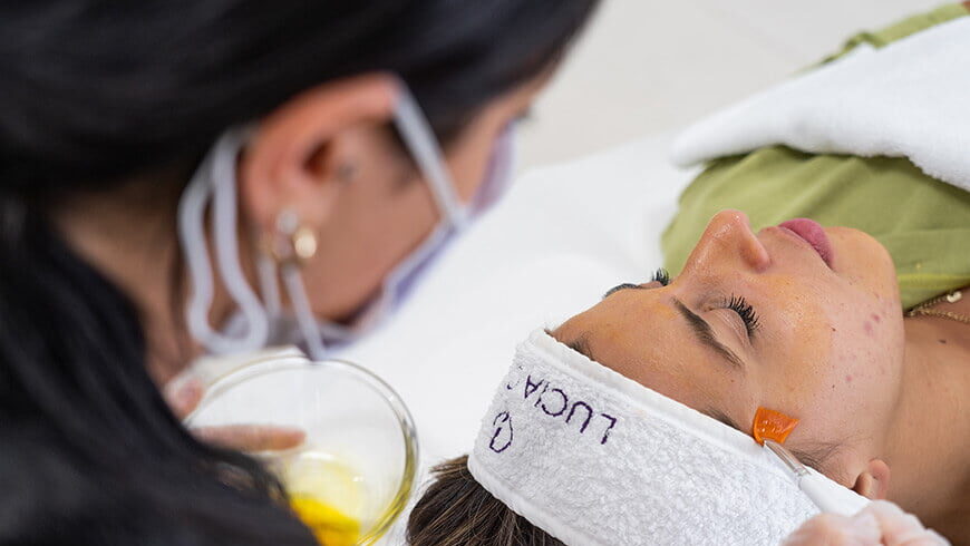 Chemical peels at Lucia Clinic
