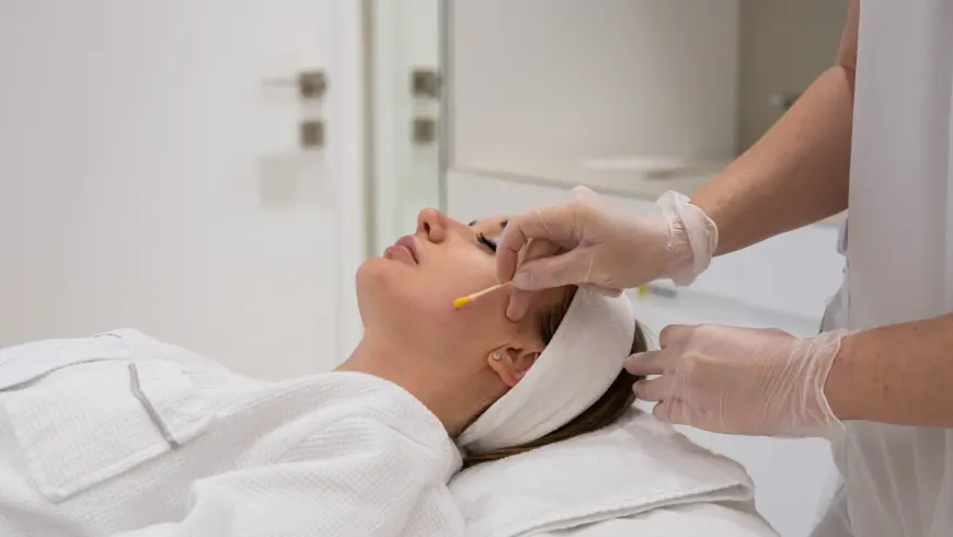 Lucia Clinic’s chemical peels treatment for acne clearing