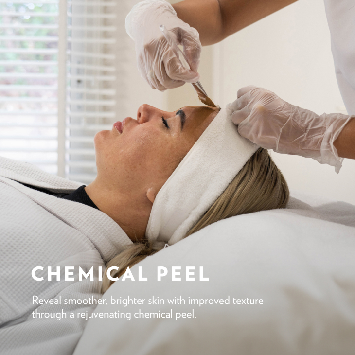 chemical peel