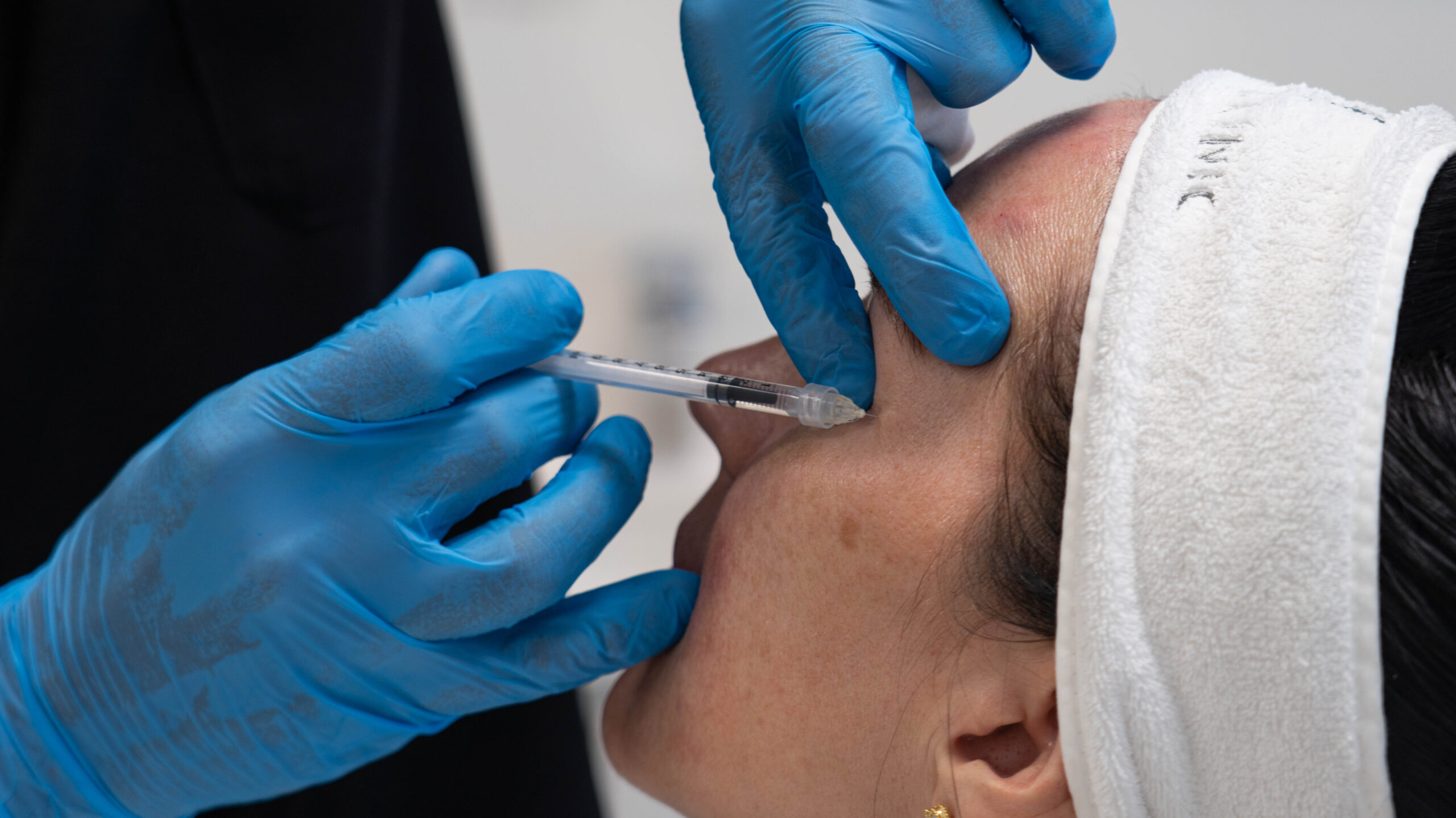 A person getting hyaluronic filler as one of the best treatments for dark circles under eyes