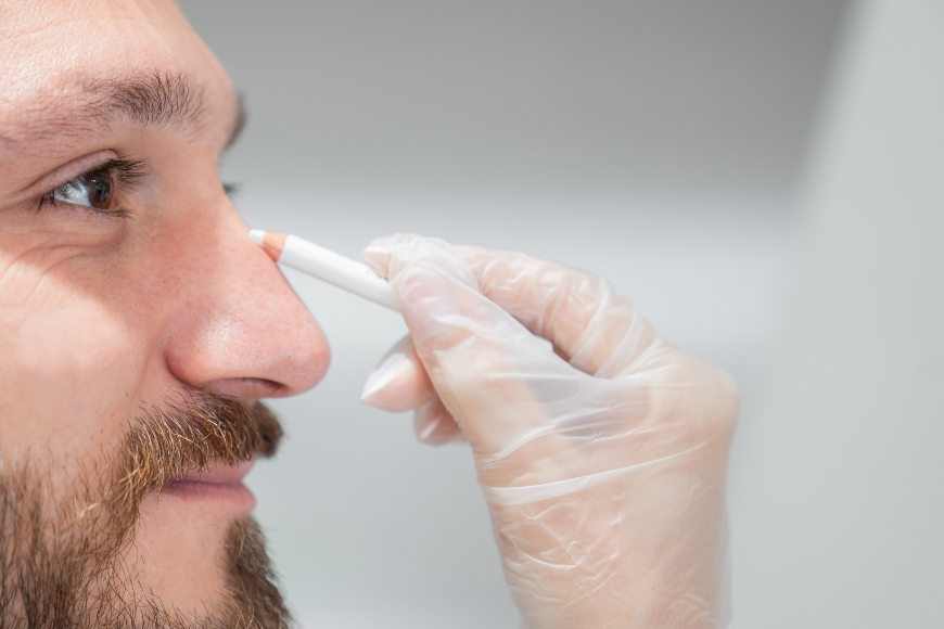 non surgical rhinoplasty men