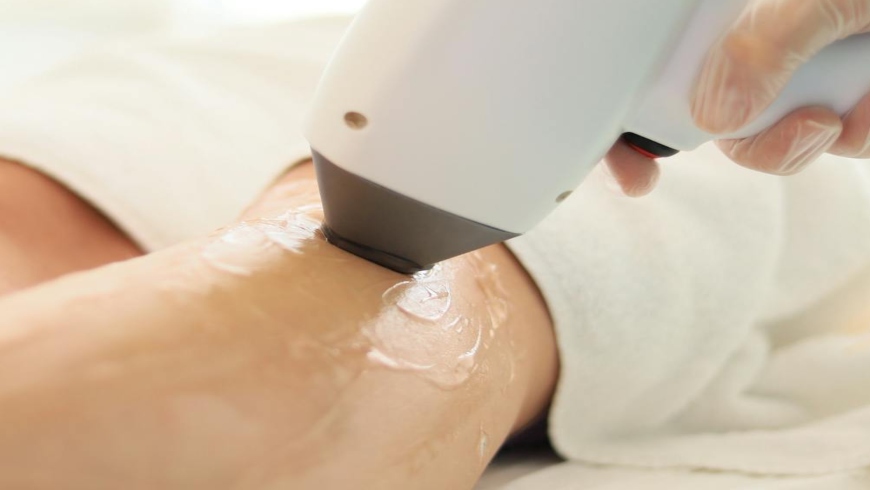 A technician performs laser hair removal on a patient's leg as part of advanced keratosis pilaris treatments to achieve smoother, hair-free skin.