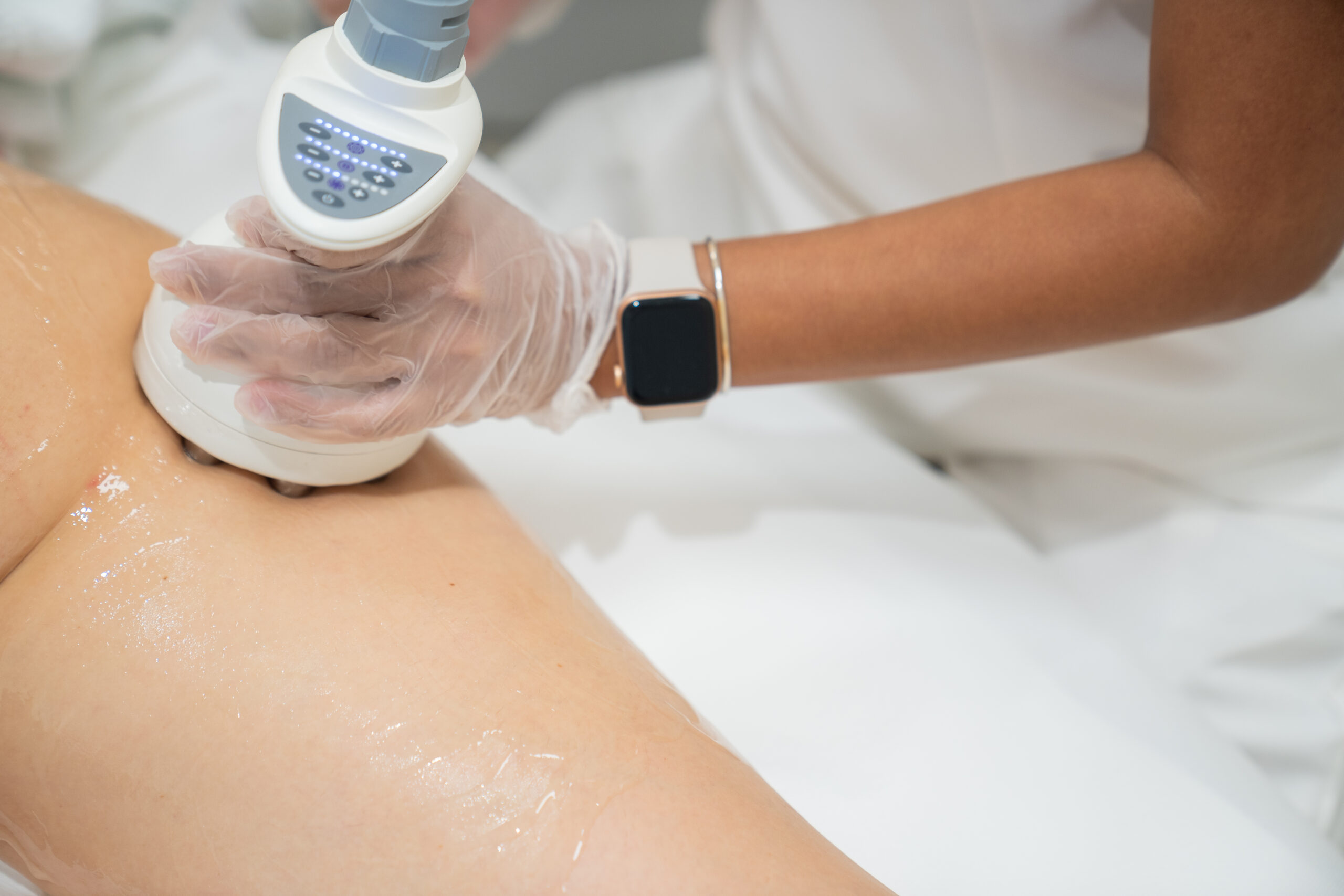 treating cellulite