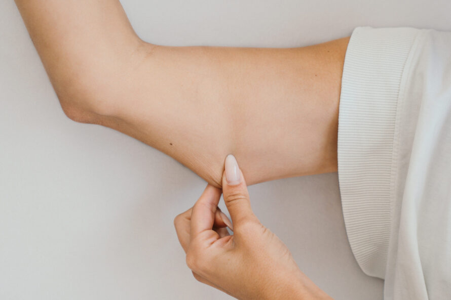A woman touching sagging skin after weight loss