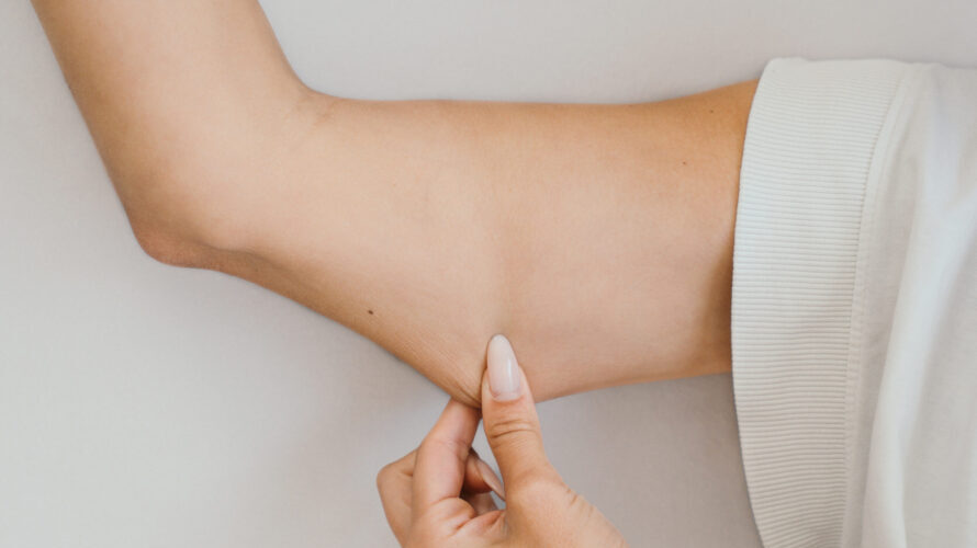 A woman touching sagging skin after weight loss