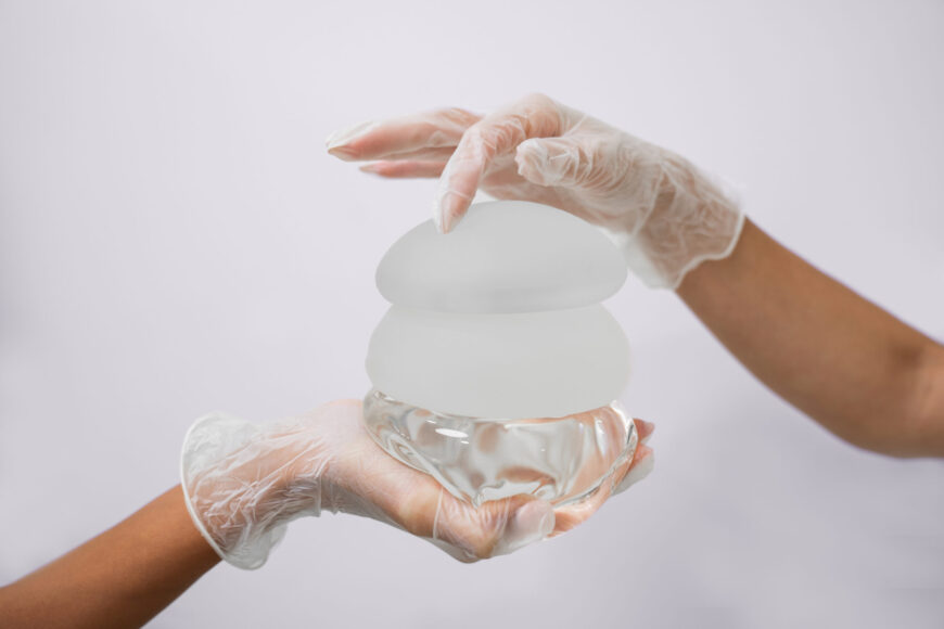 Breast implants