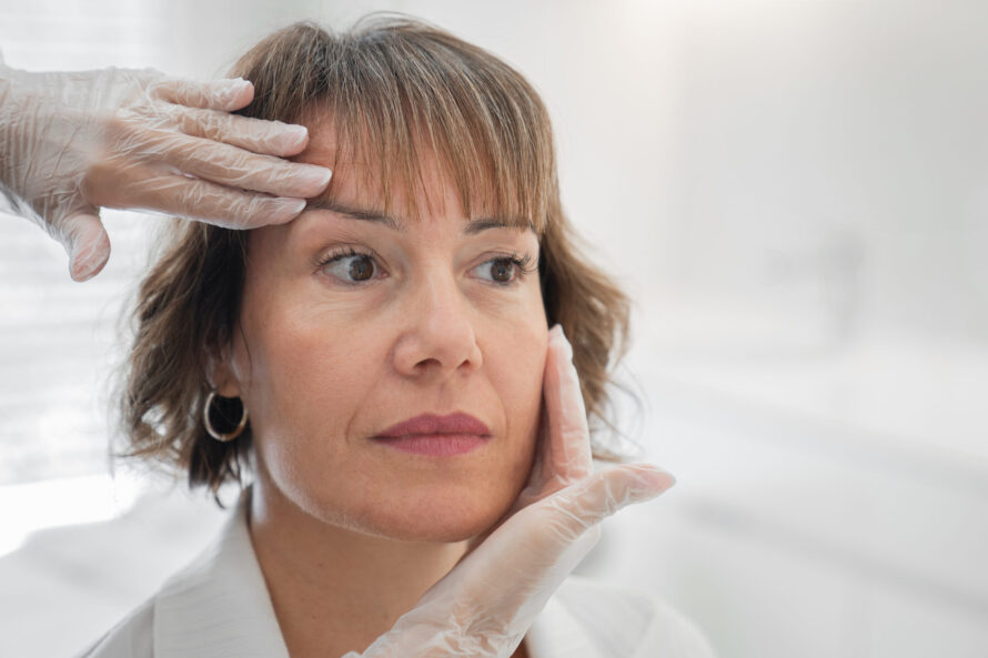 A woman after blepharoplasty