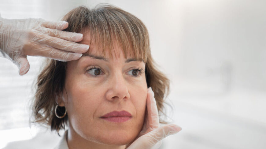 A woman before plastic surgery