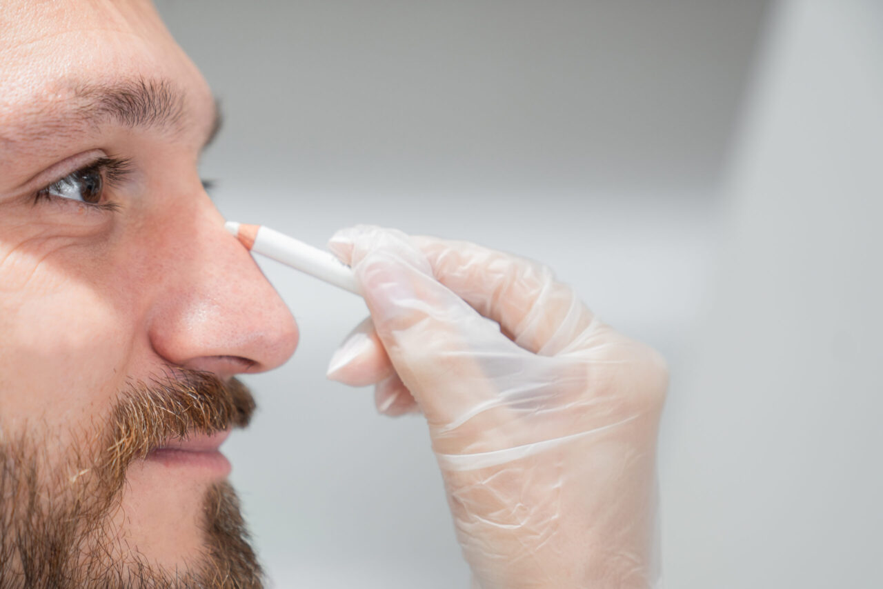 A man getting a nose job