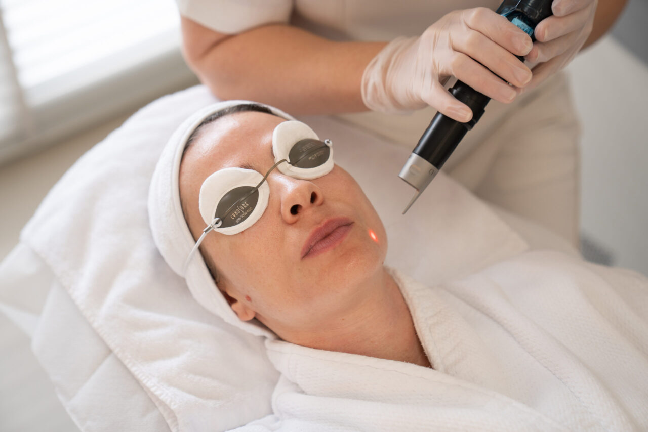 Getting Picosure before maintainance treatments