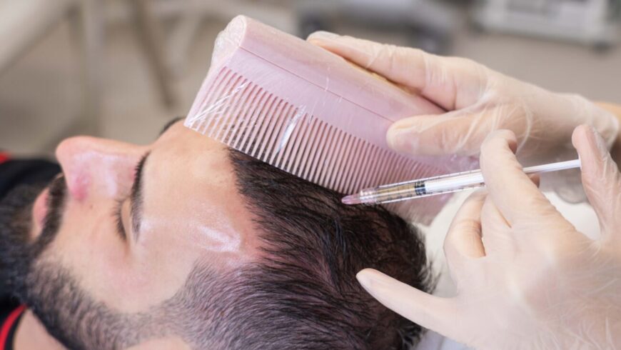 Hair loss treatment