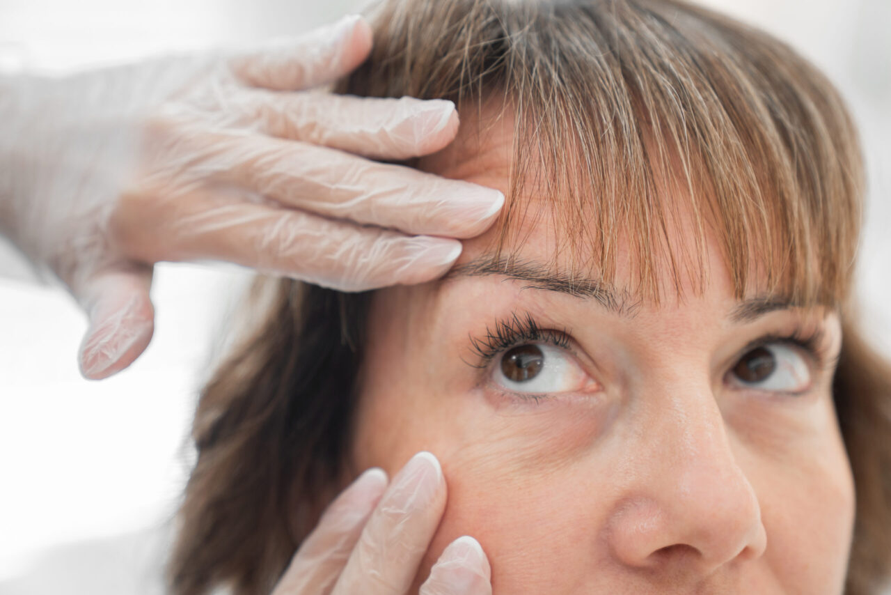 A woman getting eye lid surgery