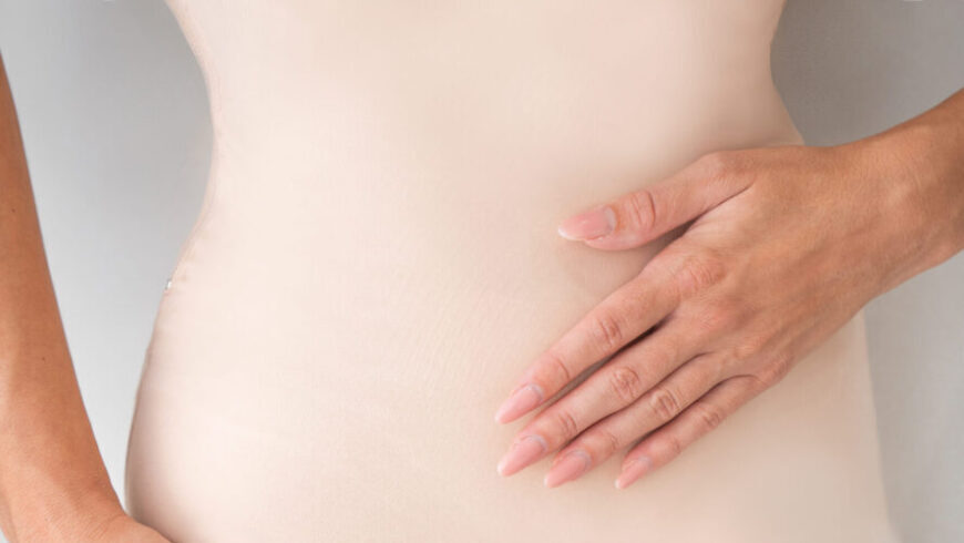 A woman with flat stomach after a liposuction.