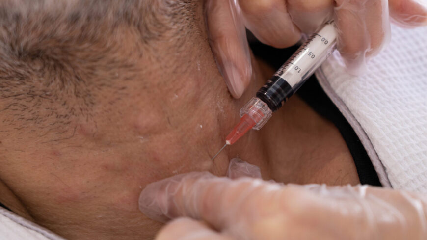 A man getting a preventative treatment