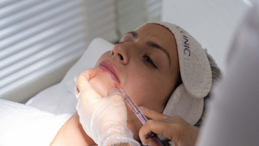 A doctor assessing a patient before Skinfill Bacio for lip ageing